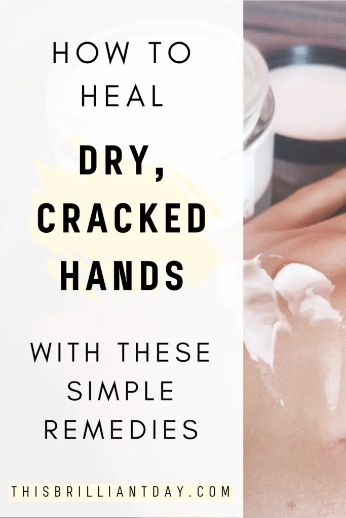 How to Heal Dry, Cracked Hands with these Simple Remedies